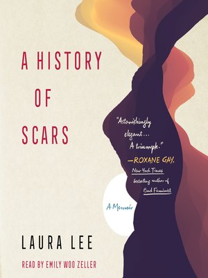 A History of Scars - Audiobook